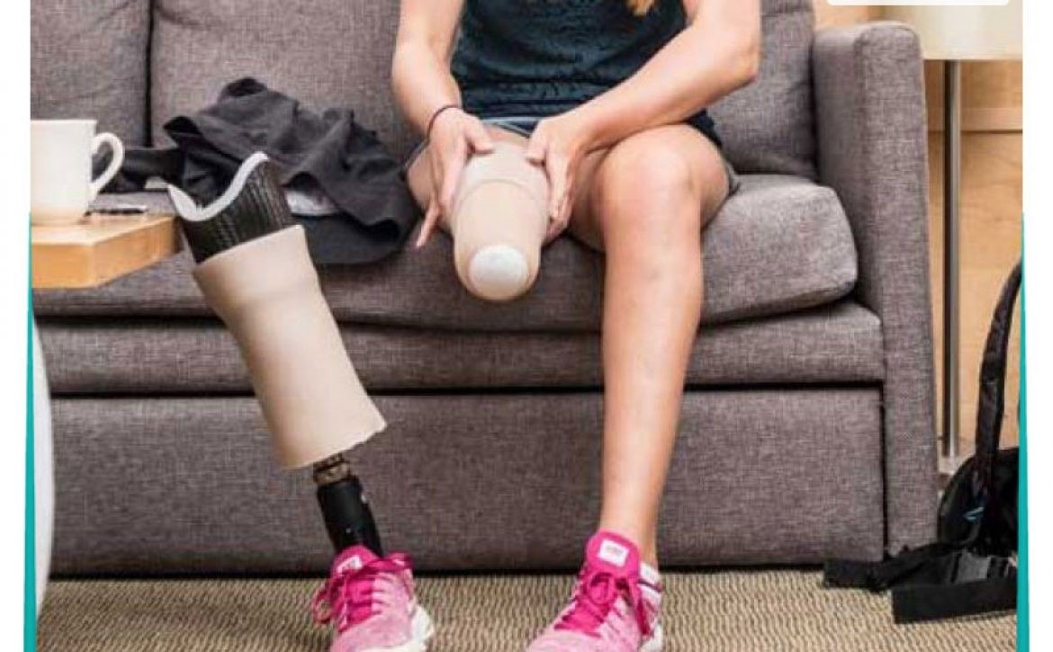 استفاده از پروتز برای عضو قطع شده از بالای ران