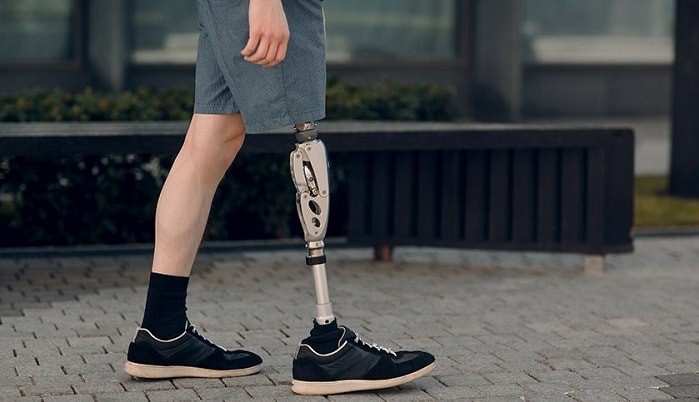 استفاده از پروتز پای مصنوعی برای بهبود در راه رفتن