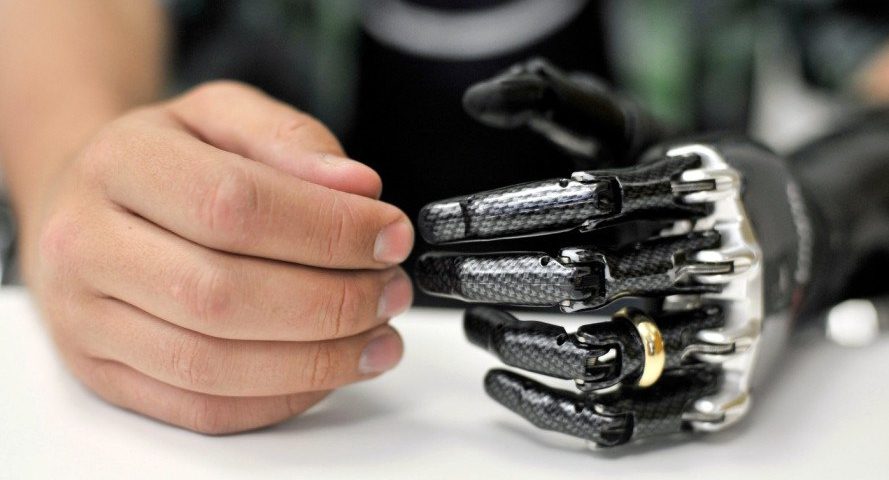 توجه به معایب هریک از انواع دست مصنوعی