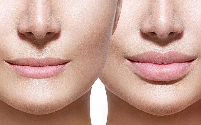 صفر تا صد مهم‌ترین نکات درباره انواع پروتز زیبایی